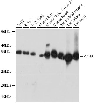 Western blot analysis of various lysates using PDHB Rabbit mAbat 1:1000 dilution.|Secondary antibody: HRP-conjugated Goat anti-Rabbit IgG (H+L) at 1:10000 dilution.|Lysates/proteins: 25 μg per lane.|Blocking buffer: 3% nonfat dry milk in TBST.|Detection: ECL Basic Kit.|Exposure time: 10s.