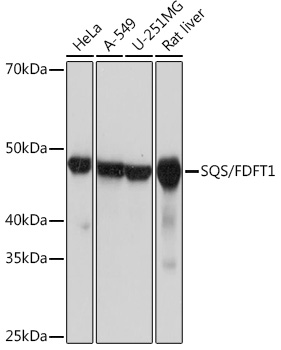 Western blot analysis of various lysates using SQS/FDFT1 Rabbit mAb at 1:1000 dilution.|Secondary antibody: HRP-conjugated Goat anti-Rabbit IgG (H+L) at 1:10000 dilution.|Lysates/proteins: 25μg per lane.|Blocking buffer: 3% nonfat dry milk in TBST.|Detection: ECL Basic Kit.|Exposure time: 3s.