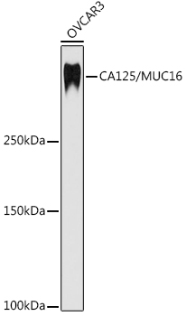 Western blot analysis of lysates from OVCAR3 cells, using CA125 / MUC16 Rabbit mAb at 1:1000 dilution.|Secondary antibody: HRP-conjugated Goat anti-Rabbit IgG (H+L) at 1:10000 dilution.|Lysates/proteins: 25μg per lane.|Blocking buffer: 3% nonfat dry milk in TBST.|Detection: ECL Basic Kit.|Exposure time: 180s.