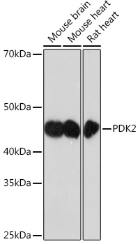 Western blot analysis of various lysates using PDK2 Rabbit mAb at 1:1000 dilution.|Secondary antibody: HRP-conjugated Goat anti-Rabbit IgG (H+L) at 1:10000 dilution.|Lysates/proteins: 25μg per lane.|Blocking buffer: 3% nonfat dry milk in TBST.|Detection: ECL Enhanced Kit.|Exposure time: 3min.