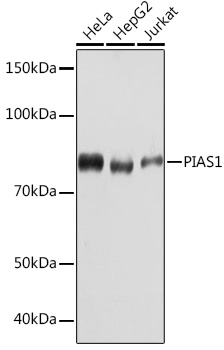 Western blot analysis of various lysates using PIAS1 Rabbit mAb at 1:1000 dilution.|Secondary antibody: HRP-conjugated Goat anti-Rabbit IgG (H+L) at 1:10000 dilution.|Lysates/proteins: 25μg per lane.|Blocking buffer: 3% nonfat dry milk in TBST.|Detection: ECL Basic Kit.|Exposure time: 60s.