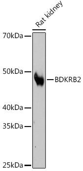 Western blot analysis of lysates from Rat kidney, using BDKRB2 Rabbit mAb at 1:500 dilution.|Secondary antibody: HRP-conjugated Goat anti-Rabbit IgG (H+L) at 1:10000 dilution.|Lysates/proteins: 25μg per lane.|Blocking buffer: 3% nonfat dry milk in TBST.|Detection: ECL Basic Kit.|Exposure time: 3min.