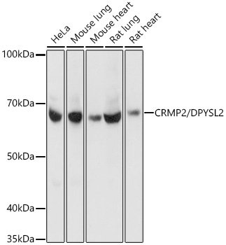 Western blot analysis of various lysates using CRMP2/DPYSL2 Rabbit mAb (A4411) at 1:1000 dilution.|Secondary antibody: HRP-conjugated Goat anti-Rabbit IgG (H+L) (AS014) at 1:10000 dilution.|Lysates/proteins: 25μg per lane.|Blocking buffer: 3% nonfat dry milk in TBST.|Detection: ECL Basic Kit (RM00020).|Exposure time: 3s.