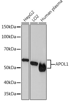 Western blot analysis of various lysates using APOL1 Rabbit mAb at 1:1000 dilution.|Secondary antibody: HRP-conjugated Goat anti-Rabbit IgG (H+L) at 1:10000 dilution.|Lysates/proteins: 25μg per lane.|Blocking buffer: 3% nonfat dry milk in TBST.|Detection: ECL Basic Kit.|Exposure time: 3min.