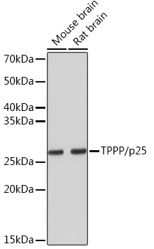 Western blot analysis of various lysates using TPPP/p25 Rabbit mAb (A4637) at 1:5000 dilution.|Secondary antibody: HRP-conjugated Goat anti-Rabbit IgG (H+L) (AS014) at 1:10000 dilution.|Lysates/proteins: 25μg per lane.|Blocking buffer: 3% nonfat dry milk in TBST.|Detection: ECL Basic Kit (RM00020).|Exposure time: 3min.