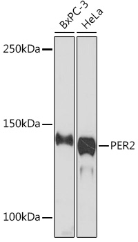 Western blot analysis of various lysates using PER2 Rabbit mAb at 1:1000 dilution.|Secondary antibody: HRP-conjugated Goat anti-Rabbit IgG (H+L) at 1:10000 dilution.|Lysates/proteins: 25μg per lane.|Blocking buffer: 3% nonfat dry milk in TBST.|Detection: ECL Enhanced Kit.|Exposure time: 3min.