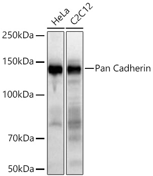 Western blot analysis of various lysates using Pan Cadherin Rabbit mAb at 1:1000 dilution incubated at room temperature for 1.5 hours.|Secondary antibody: HRP-conjugated Goat anti-Rabbit IgG (H+L) at 1:10000 dilution.|Lysates/proteins: 25 μg per lane.|Blocking buffer: 3% nonfat dry milk in TBST.|Detection: ECL Basic Kit.|Exposure time: 20 s.
