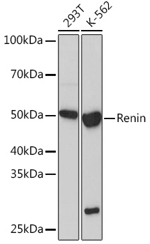 Western blot analysis of various lysates using Renin Rabbit mAb at 1:1000 dilution.|Secondary antibody: HRP-conjugated Goat anti-Rabbit IgG (H+L) at 1:10000 dilution.|Lysates/proteins: 25μg per lane.|Blocking buffer: 3% nonfat dry milk in TBST.|Detection: ECL Basic Kit.|Exposure time: 3min.