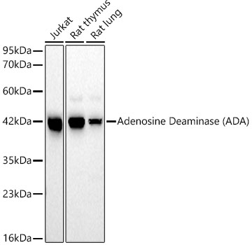 Western blot analysis of various lysates, using Adenosine Deaminase Rabbit mAb at 1:1000 dilution.|Secondary antibody: HRP-conjugated Goat anti-Rabbit IgG (H+L) at 1:10000 dilution.|Lysates/proteins: 25μg per lane.|Blocking buffer: 3% nonfat dry milk in TBST.|Detection: ECL Basic Kit.|Exposure time: 60s.