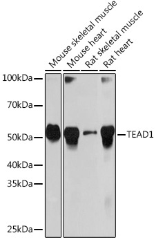Western blot analysis of various lysates using TEAD1 Rabbit mAb (A5218) at 1:1000 dilution.|Secondary antibody: HRP-conjugated Goat anti-Rabbit IgG (H+L) (AS014) at 1:10000 dilution.|Lysates/proteins: 25μg per lane.|Blocking buffer: 3% nonfat dry milk in TBST.|Detection: ECL Basic Kit (RM00020).|Exposure time: 10s.