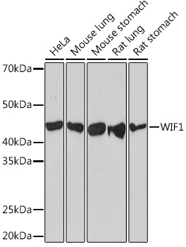 Western blot analysis of various lysates using WIF1 Rabbit mAb (A5171) at 1:1000 dilution.|Secondary antibody: HRP-conjugated Goat anti-Rabbit IgG (H+L) (AS014) at 1:10000 dilution.|Lysates/proteins: 25μg per lane.|Blocking buffer: 3% nonfat dry milk in TBST.|Detection: ECL Basic Kit (RM00020).|Exposure time: 3min.