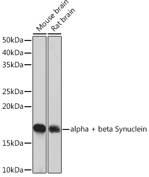 Western blot analysis of various lysates using alpha + beta Synuclein  Rabbit mAb at 1:1000 dilution.|Secondary antibody: HRP-conjugated Goat anti-Rabbit IgG (H+L) at 1:10000 dilution.|Lysates/proteins: 25μg per lane.|Blocking buffer: 3% nonfat dry milk in TBST.|Detection: ECL Basic Kit.|Exposure time: 1min.