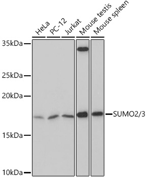 Western blot analysis of various lysates using SUMO2/3 Rabbit mAb at 1:500 dilution.|Secondary antibody: HRP-conjugated Goat anti-Rabbit IgG (H+L) at 1:10000 dilution.|Lysates/proteins: 25μg per lane.|Blocking buffer: 3% nonfat dry milk in TBST.|Detection: ECL Basic Kit.|Exposure time: 3min.
