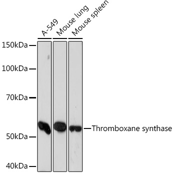 Western blot analysis of various lysates using Thromboxane synthase Rabbit mAb (A5173) at 1:1000 dilution.|Secondary antibody: HRP-conjugated Goat anti-Rabbit IgG (H+L) (AS014) at 1:10000 dilution.|Lysates/proteins: 25μg per lane.|Blocking buffer: 3% nonfat dry milk in TBST.|Detection: ECL Enhanced Kit (RM00021).|Exposure time: 90s.