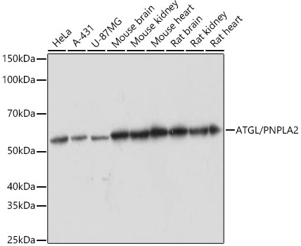 Western blot analysis of various lysates using ATGL/PNPLA2 Rabbit mAb at 1:1000 dilution.|Secondary antibody: HRP-conjugated Goat anti-Rabbit IgG (H+L) at 1:10000 dilution.|Lysates/proteins: 25μg per lane.|Blocking buffer: 3% nonfat dry milk in TBST.|Detection: ECL Basic Kit.|Exposure time: 60s.