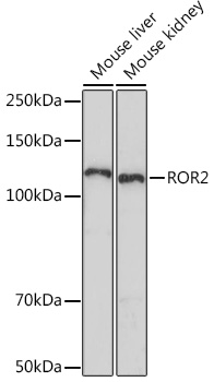 Western blot analysis of various lysates using ROR2 Rabbit mAb at 1:1000 dilution.|Secondary antibody: HRP-conjugated Goat anti-Rabbit IgG (H+L) at 1:10000 dilution.|Lysates/proteins: 25μg per lane.|Blocking buffer: 3% nonfat dry milk in TBST.|Detection: ECL Enhanced Kit.|Exposure time: 90s.