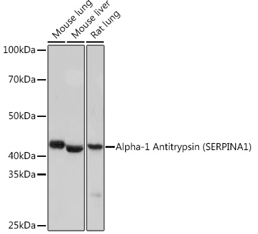 Western blot analysis of various lysates using Alpha-1 Antitrypsin) Rabbit mAb at 1:1000 dilution.|Secondary antibody: HRP-conjugated Goat anti-Rabbit IgG (H+L) at 1:10000 dilution.|Lysates/proteins: 25μg per lane.|Blocking buffer: 3% nonfat dry milk in TBST.|Detection: ECL Basic Kit.|Exposure time: 1s.