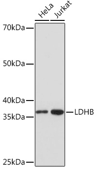 Western blot analysis of various lysates using LDHB Rabbit mAb at 1:1000 dilution.|Secondary antibody: HRP-conjugated Goat anti-Rabbit IgG (H+L) at 1:10000 dilution.|Lysates/proteins: 25μg per lane.|Blocking buffer: 3% nonfat dry milk in TBST.|Detection: ECL Basic Kit.|Exposure time: 5s.
