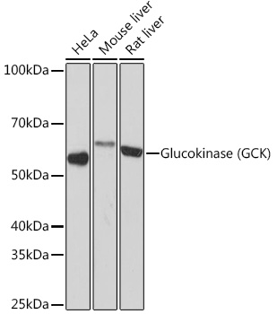Western blot analysis of various lysates using Glucokinase (GCK) (GCK) Rabbit mAb at 1:1000 dilution.|Secondary antibody: HRP-conjugated Goat anti-Rabbit IgG (H+L) at 1:10000 dilution.|Lysates/proteins: 25μg per lane.|Blocking buffer: 3% nonfat dry milk in TBST.|Detection: ECL Basic Kit.|Exposure time: 30s.