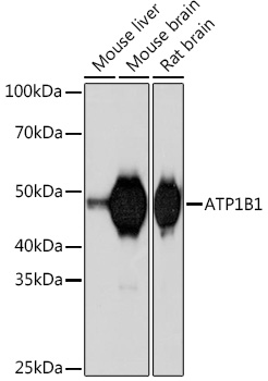 Western blot analysis of various lysates using ATP1B1 Rabbit mAb at 1:1000 dilution.|Secondary antibody: HRP-conjugated Goat anti-Rabbit IgG (H+L) at 1:10000 dilution.|Lysates/proteins: 25μg per lane.|Blocking buffer: 3% nonfat dry milk in TBST.|Detection: ECL Basic Kit.|Exposure time: 90s.