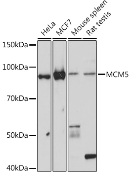 Western blot analysis of various lysates using MCM5 Rabbit mAb at 1:1000 dilution.|Secondary antibody: HRP-conjugated Goat anti-Rabbit IgG (H+L) at 1:10000 dilution.|Lysates/proteins: 25μg per lane.|Blocking buffer: 3% nonfat dry milk in TBST.|Detection: ECL Basic Kit.|Exposure time: 60s.