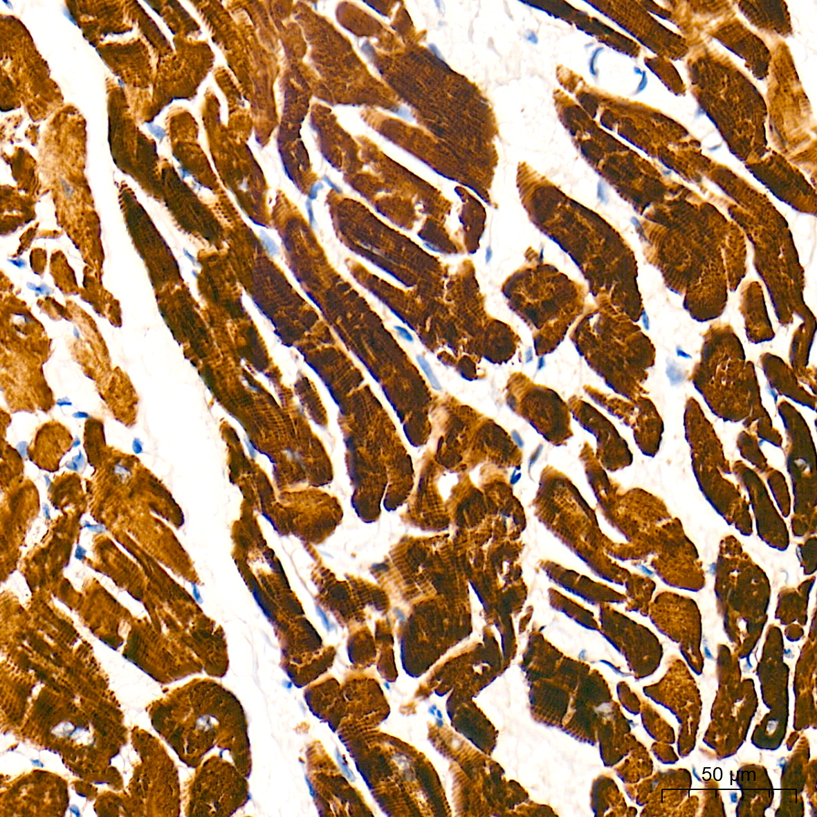 Immunohistochemistry analysis of paraffin-embedded Human heart tissue using Cardiac troponin T (TNNT2) Rabbit mAb at a dilution of 1:200 (40x lens). High pressure antigen retrieval performed with 0.01M Tris-EDTA Buffer (pH 9.0) prior to IHC staining.