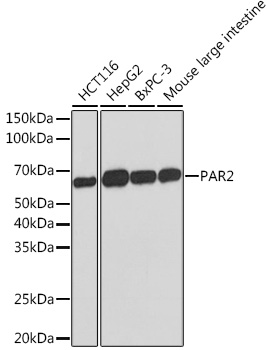 Western blot analysis of various lysates using PAR2 Rabbit mAb at 1:1000 dilution.|Secondary antibody: HRP-conjugated Goat anti-Rabbit IgG (H+L) at 1:10000 dilution.|Lysates/proteins: 25μg per lane.|Blocking buffer: 3% nonfat dry milk in TBST.|Detection: ECL Basic Kit.|Exposure time: 3min.