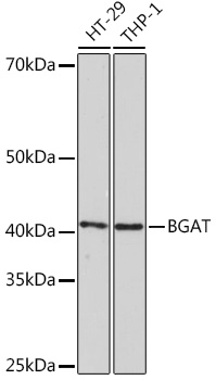 Western blot analysis of various lysates using BGAT Rabbit mAb at 1:1000 dilution.|Secondary antibody: HRP-conjugated Goat anti-Rabbit IgG (H+L) at 1:10000 dilution.|Lysates/proteins: 25μg per lane.|Blocking buffer: 3% nonfat dry milk in TBST.|Detection: ECL Enhanced Kit.|Exposure time: 3min.
