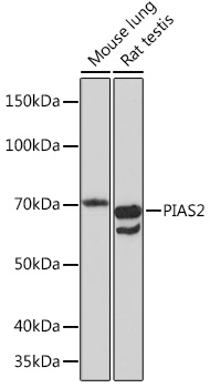 Western blot analysis of various lysates using PIAS2 Rabbit mAb at 1:1000 dilution.|Secondary antibody: HRP-conjugated Goat anti-Rabbit IgG (H+L) at 1:10000 dilution.|Lysates/proteins: 25μg per lane.|Blocking buffer: 3% nonfat dry milk in TBST.|Detection: ECL Basic Kit.|Exposure time: 180s.