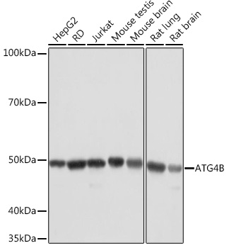 Western blot analysis of various lysates using ATG4B Rabbit mAb at 1:1000 dilution.|Secondary antibody: HRP-conjugated Goat anti-Rabbit IgG (H+L) at 1:10000 dilution.|Lysates/proteins: 25μg per lane.|Blocking buffer: 3% nonfat dry milk in TBST.|Detection: ECL Basic Kit.|Exposure time: 10s.