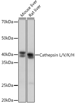 Western blot analysis of various lysates using Cathepsin L/V/K/H Rabbit mAb at 1:1000 dilution.|Secondary antibody: HRP-conjugated Goat anti-Rabbit IgG (H+L) at 1:10000 dilution.|Lysates/proteins: 25μg per lane.|Blocking buffer: 3% nonfat dry milk in TBST.|Detection: ECL Basic Kit.|Exposure time: 1s.