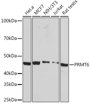 Western blot analysis of various lysates using PRMT6 Rabbit mAb at 1:1000 dilution.|Secondary antibody: HRP-conjugated Goat anti-Rabbit IgG (H+L) at 1:10000 dilution.|Lysates/proteins: 25μg per lane.|Blocking buffer: 3% nonfat dry milk in TBST.|Detection: ECL Basic Kit.|Exposure time: 1min.