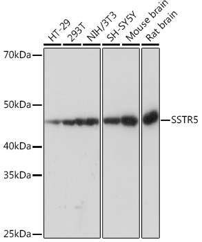 Western blot analysis of various lysates using SSTR5 Rabbit mAb at 1:1000 dilution.|Secondary antibody: HRP-conjugated Goat anti-Rabbit IgG (H+L) at 1:10000 dilution.|Lysates/proteins: 25μg per lane.|Blocking buffer: 3% nonfat dry milk in TBST.|Detection: ECL Basic Kit.|Exposure time: 3s.