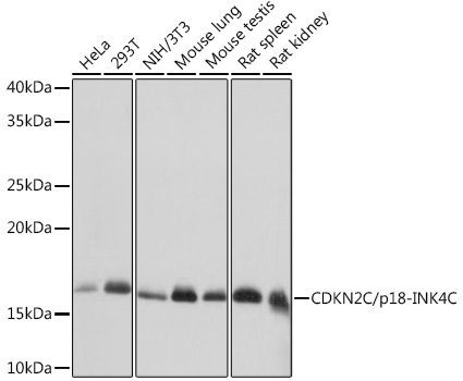 Western blot analysis of various lysates using [KD Validated] CDKN2C/p18-INK4C Rabbit mAb (A8751) at 1:1000 dilution.|Secondary antibody: HRP-conjugated Goat anti-Rabbit IgG (H+L) (AS014) at 1:10000 dilution.|Lysates/proteins: 25μg per lane.|Blocking buffer: 3% nonfat dry milk in TBST.|Detection: ECL Basic Kit (RM00020).|Exposure time: 1s.