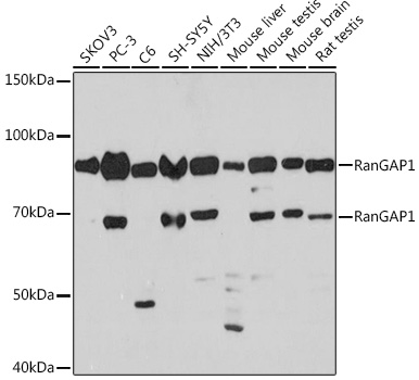 Western blot analysis of various lysates using RanGAP1 Rabbit mAb at 1:1000 dilution.|Secondary antibody: HRP-conjugated Goat anti-Rabbit IgG (H+L) at 1:10000 dilution.|Lysates/proteins: 25μg per lane.|Blocking buffer: 3% nonfat dry milk in TBST.|Detection: ECL Basic Kit.|Exposure time: 3min.