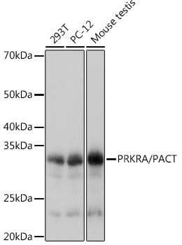 Western blot analysis of various lysates using PRKRA/PACTRabbit mAb at 1:1000 dilution.|Secondary antibody: HRP-conjugated Goat anti-Rabbit IgG (H+L) at 1:10000 dilution.|Lysates/proteins: 25μg per lane.|Blocking buffer: 3% nonfat dry milk in TBST.|Detection: ECL Basic Kit.|Exposure time: 1s.