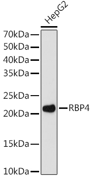 Western blot analysis of lysates from HepG2 cells, using RBP4 Rabbit mAb at 1:1000 dilution.|Secondary antibody: HRP-conjugated Goat anti-Rabbit IgG (H+L) at 1:10000 dilution.|Lysates/proteins: 25μg per lane.|Blocking buffer: 3% nonfat dry milk in TBST.|Detection: ECL Enhanced Kit.|Exposure time: 180s.