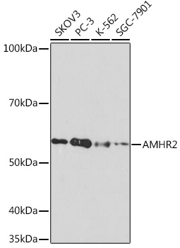 Western blot analysis of various lysates using AMHR2 Rabbit mAb at 1:1000 dilution.|Secondary antibody: HRP-conjugated Goat anti-Rabbit IgG (H+L) at 1:10000 dilution.|Lysates/proteins: 25μg per lane.|Blocking buffer: 3% nonfat dry milk in TBST.|Detection: ECL Basic Kit.|Exposure time: 3min.