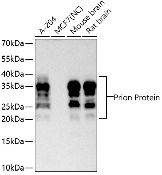 Western blot analysis of various lysates using Prion Protein Rabbit mAb at 1:1000 dilution incubated at room temperature for 1.5 hours.|Secondary antibody: HRP-conjugated Goat anti-Rabbit IgG (H+L) at 1:10000 dilution.|Lysates/proteins: 25 μg per lane.|Blocking buffer: 3% nonfat dry milk in TBST.|Detection: ECL Basic Kit.|Negative control (NC): MCF7.|Exposure time: 60 s.