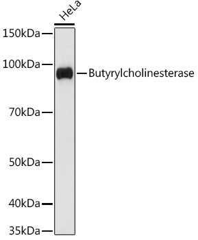 Western blot analysis of lysates from HeLa cells, using Butyrylcholinesterase Rabbit mAb at 1:1000 dilution.|Secondary antibody: HRP-conjugated Goat anti-Rabbit IgG (H+L) at 1:10000 dilution.|Lysates/proteins: 25μg per lane.|Blocking buffer: 3% nonfat dry milk in TBST.|Detection: ECL Basic Kit.|Exposure time: 60s.