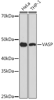 Western blot analysis of various lysates using VASP Rabbit mAb (A8862) at 1:1000 dilution.|Secondary antibody: HRP-conjugated Goat anti-Rabbit IgG (H+L) (AS014) at 1:10000 dilution.|Lysates/proteins: 25μg per lane.|Blocking buffer: 3% nonfat dry milk in TBST.|Detection: ECL Basic Kit (RM00020).|Exposure time: 90s.