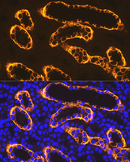 Immunofluorescence analysis of paraffin-embedded rat kidney using PDZK1 Rabbit mAb at dilution of 1:100 (40x lens). Secondary antibody: Cy3-conjugated Goat anti-Rabbit IgG (H+L) at 1:500 dilution. Blue: DAPI for nuclear staining.