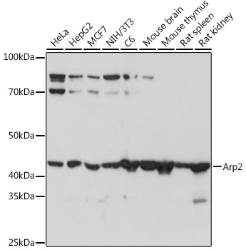 Western blot analysis of various lysates using Arp2 Rabbit mAb at 1:1000 dilution.|Secondary antibody: HRP-conjugated Goat anti-Rabbit IgG (H+L) at 1:10000 dilution.|Lysates/proteins: 25μg per lane.|Blocking buffer: 3% nonfat dry milk in TBST.|Detection: ECL Basic Kit.|Exposure time: 5s.