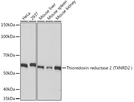 Western blot analysis of various lysates using Thioredoxin reductase 2 (TXNRD2 ) Rabbit mAb  (A8884) at 1:1000 dilution.|Secondary antibody: HRP-conjugated Goat anti-Rabbit IgG (H+L) (AS014) at 1:10000 dilution.|Lysates/proteins: 25 μg per lane.|Blocking buffer: 3% nonfat dry milk in TBST.|Detection: ECL Basic Kit (RM00020).|Exposure time: 10 s.