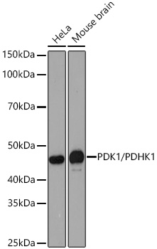 Western blot analysis of various lysates using PDK1/PDHK1 Rabbit mAb at 1:1000 dilution incubated overnight at 4℃.|Secondary antibody: HRP-conjugated Goat anti-Rabbit IgG (H+L) at 1:10000 dilution.|Lysates/proteins: 25 μg per lane.|Blocking buffer: 3% nonfat dry milk in TBST.|Detection: ECL Basic Kit.|Exposure time: 30s.