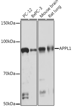 Western blot analysis of various lysates using APPL1 Rabbit mAb at 1:1000 dilution incubated overnight at 4°C|Secondary antibody: HRP-conjugated Goat anti-Rabbit IgG (H+L) at 1:10000 dilution.|Lysates/proteins: 25 μg per lane.|Blocking buffer: 3% nonfat dry milk in TBST.|Detection: ECL Basic Kit.|Exposure time: 30 s.