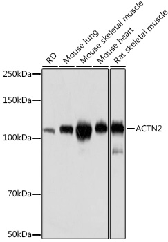 Western blot analysis of various lysates using ACTN2 Rabbit mAb at 1:3000 dilution.|Secondary antibody: HRP-conjugated Goat anti-Rabbit IgG (H+L) at 1:10000 dilution.|Lysates/proteins: 25μg per lane.|Blocking buffer: 3% nonfat dry milk in TBST.|Detection: ECL Basic Kit.|Exposure time: 1s.