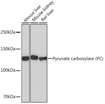 Western blot analysis of various lysates using Pyruvate carboxylase (PC) Rabbit mAb at 1:1000 dilution.|Secondary antibody: HRP-conjugated Goat anti-Rabbit IgG (H+L) at 1:10000 dilution.|Lysates/proteins: 25μg per lane.|Blocking buffer: 3% nonfat dry milk in TBST.|Detection: ECL Basic Kit.|Exposure time: 30s.