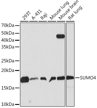 Western blot analysis of various lysates using SUMO4 Rabbit mAb at 1:500 dilution.|Secondary antibody: HRP-conjugated Goat anti-Rabbit IgG (H+L) at 1:10000 dilution.|Lysates/proteins: 25μg per lane.|Blocking buffer: 3% nonfat dry milk in TBST.|Detection: ECL Basic Kit.|Exposure time: 30s.