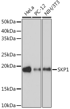 Western blot analysis of various lysates using SKP1 Rabbit mAb at 1:1000 dilution.|Secondary antibody: HRP-conjugated Goat anti-Rabbit IgG (H+L) at 1:10000 dilution.|Lysates/proteins: 25μg per lane.|Blocking buffer: 3% nonfat dry milk in TBST.|Detection: ECL Basic Kit.|Exposure time: 90s.